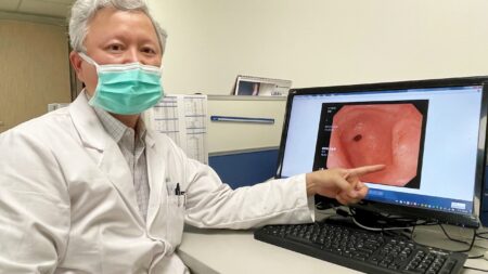 護理師胃悶痛竟罹胃癌 微創腹腔鏡手術切除病灶抗病魔