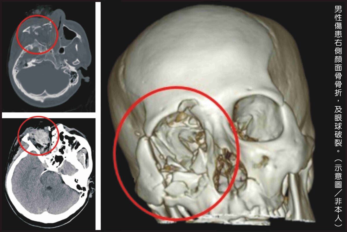 53f9ef0b3c11b6cdfd56ba1f845781a9