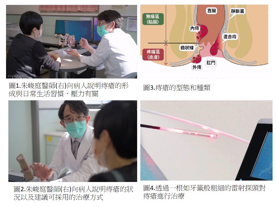 ▲嘉義基督教醫院說明痔瘡與治療方式。（圖/嘉基提供）