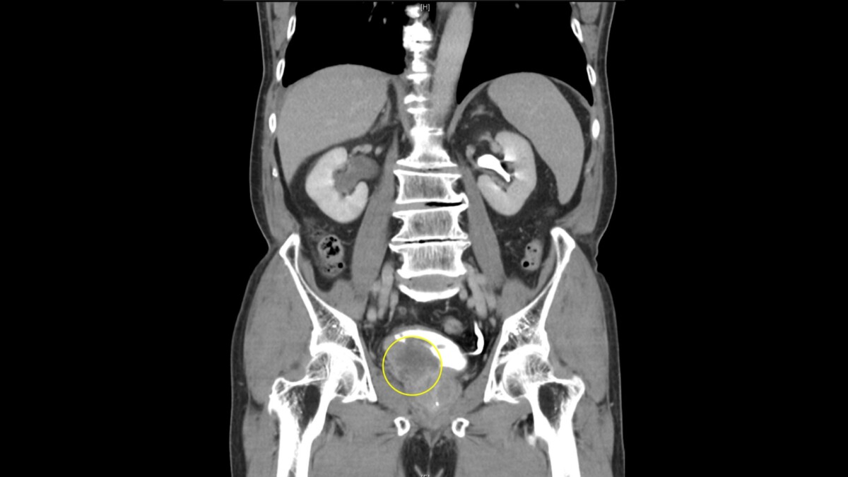 995b49f17b45026f24a49adeec46fc0f